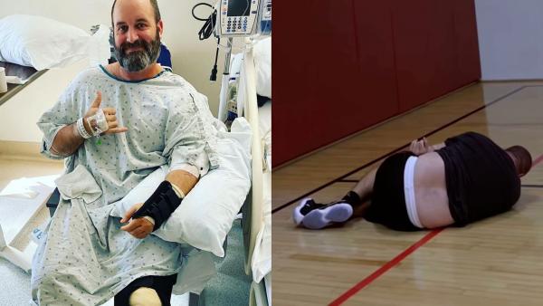 Tom Segura broke his arm playing basketball in 2020. (Photo: Tom Segura/Instagram)